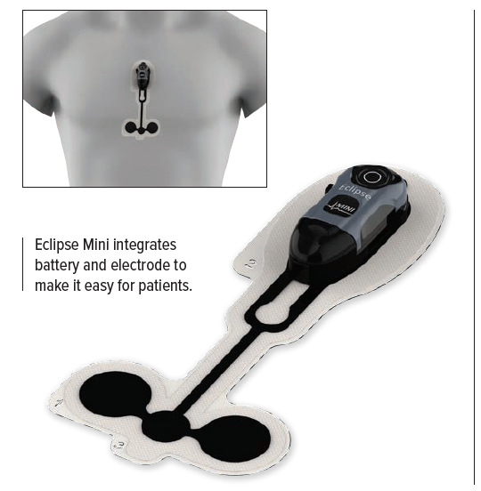 Eclipse Mini – תמונה 2
