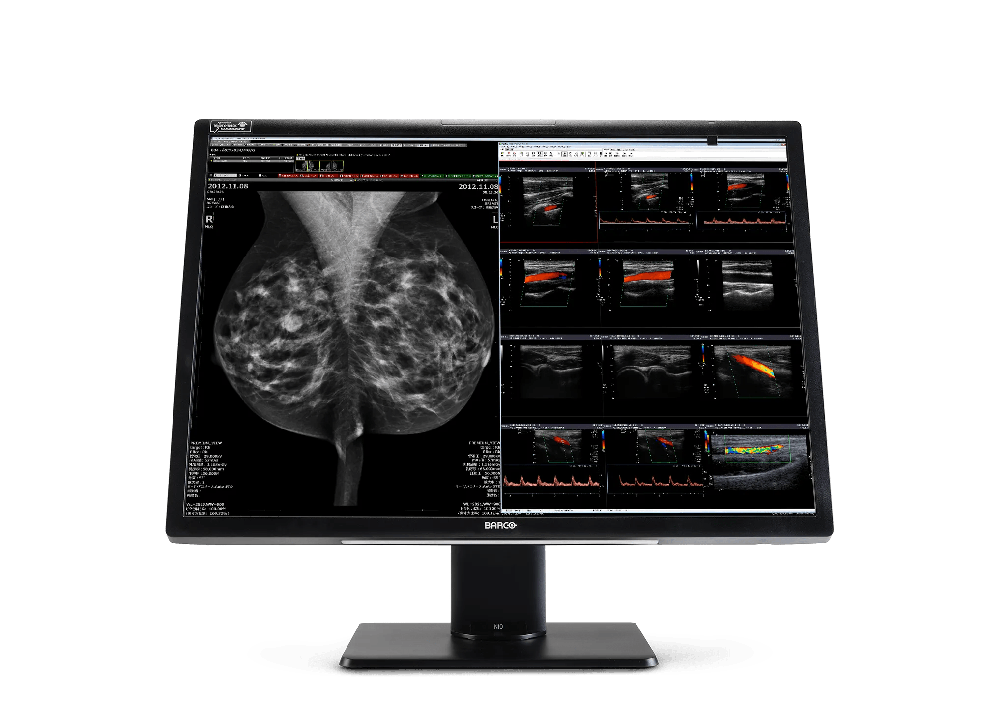 MDNC-12130 Nio Fiusion 12MP 31” Breast imaging Radiology display