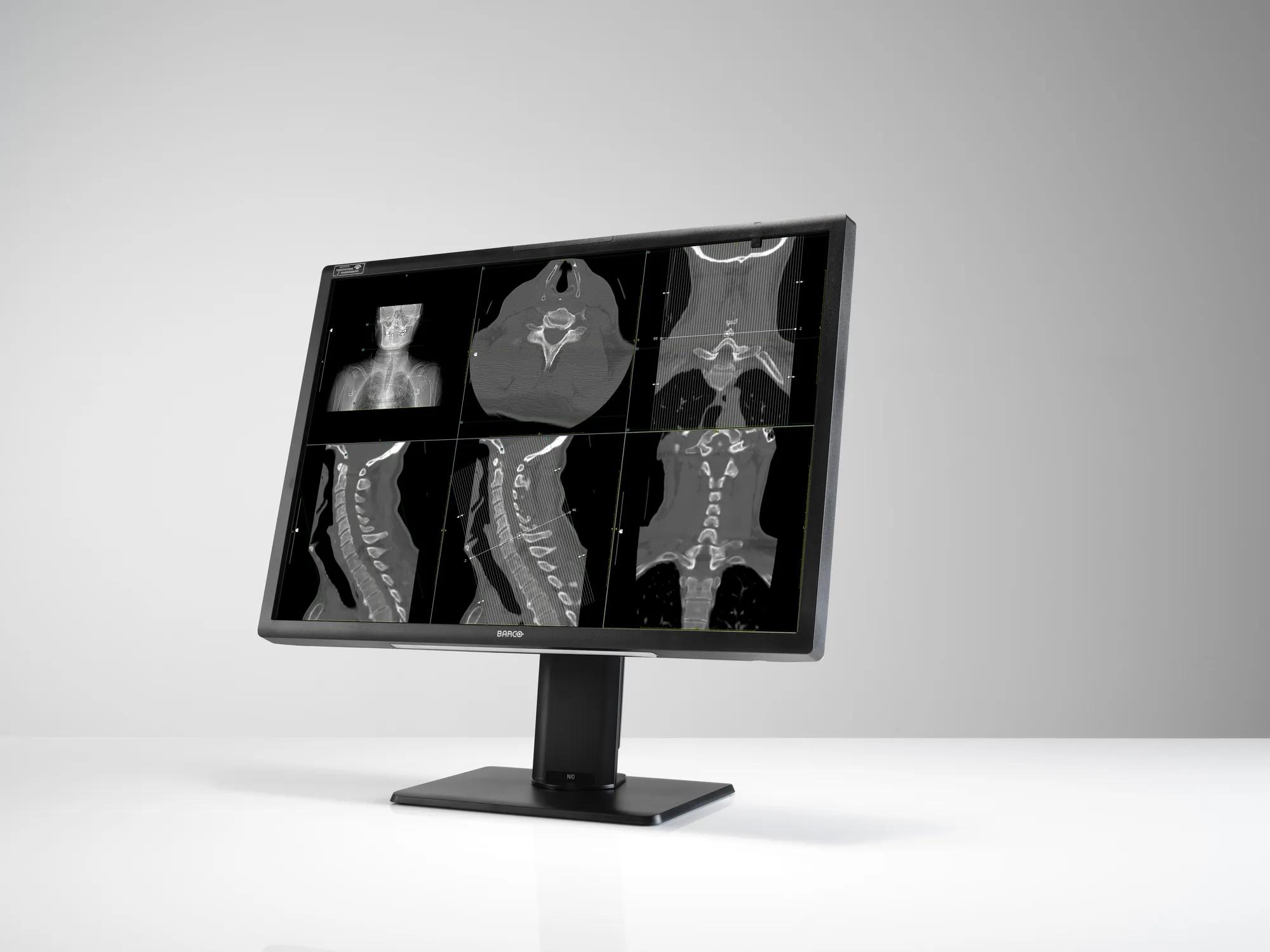 MDNC-12130 Nio Fiusion 12MP 31” Breast imaging Radiology display – תמונה 3