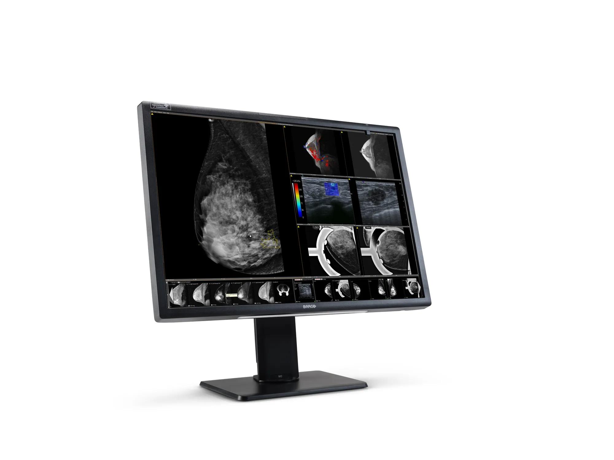 MDNC-12130 Nio Fiusion 12MP 31” Breast imaging Radiology display – תמונה 2