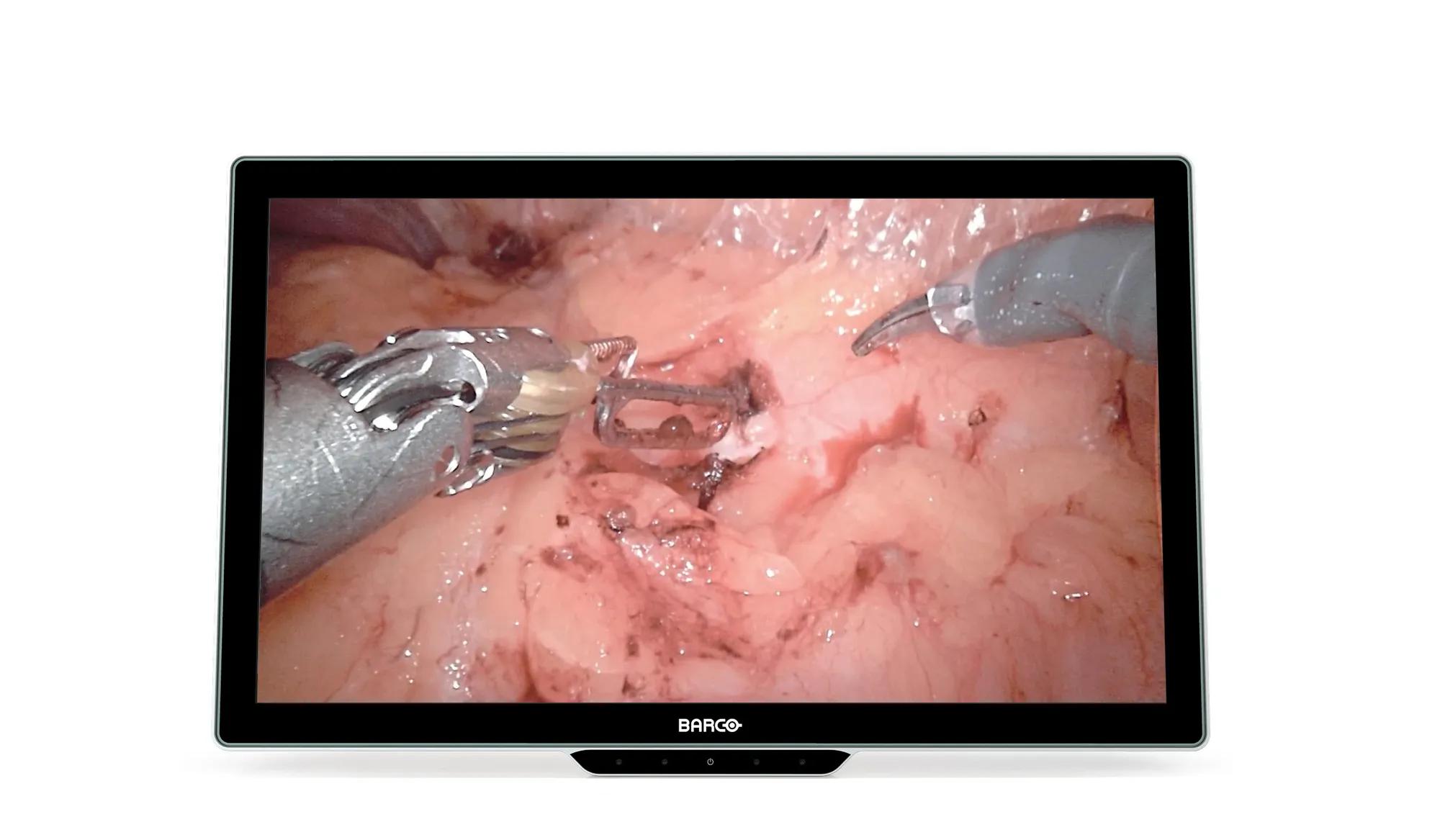 Barco Surgical display MDSC-8527 4K 27” surgical display – תמונה 2