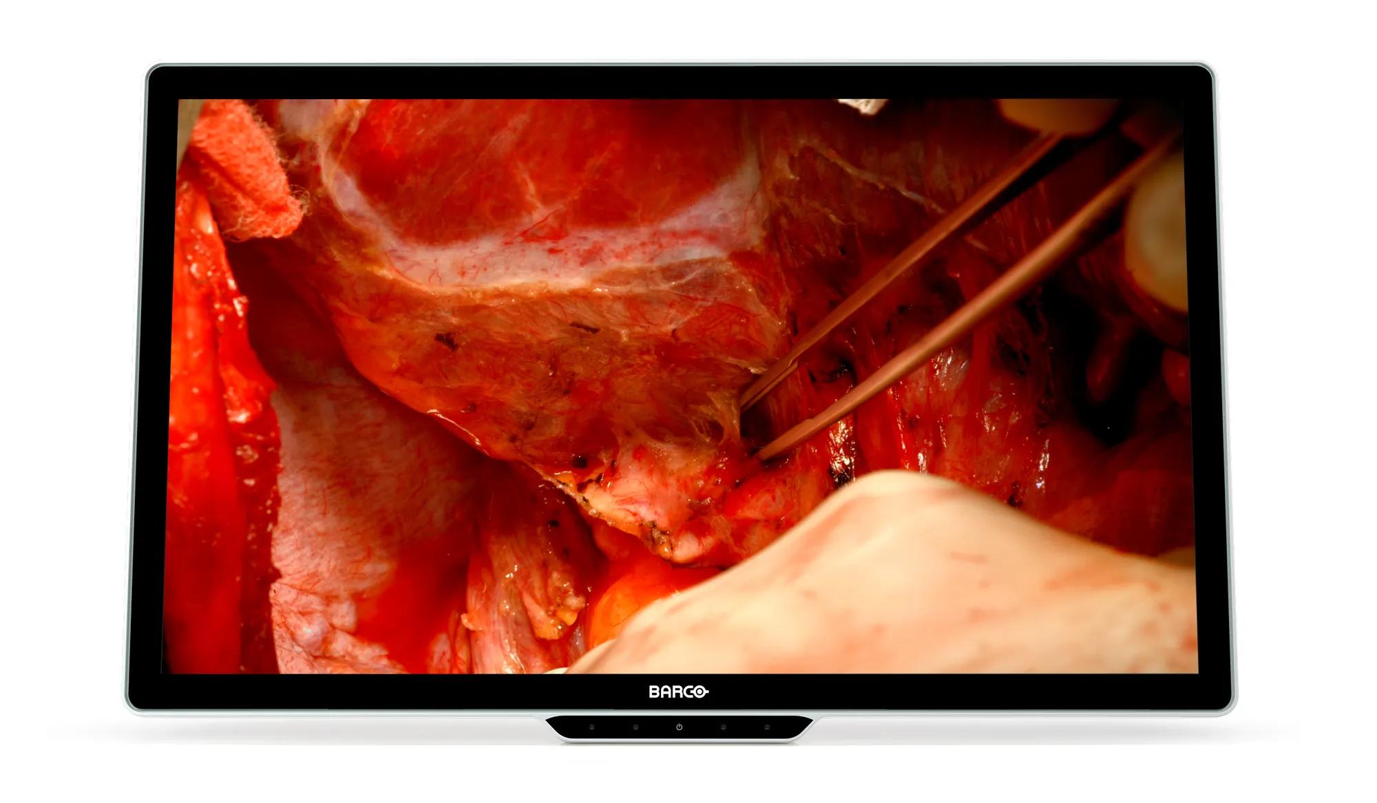 Barco Barco Surgical display MDSC-8532 4K 32” surgical display – תמונה 2